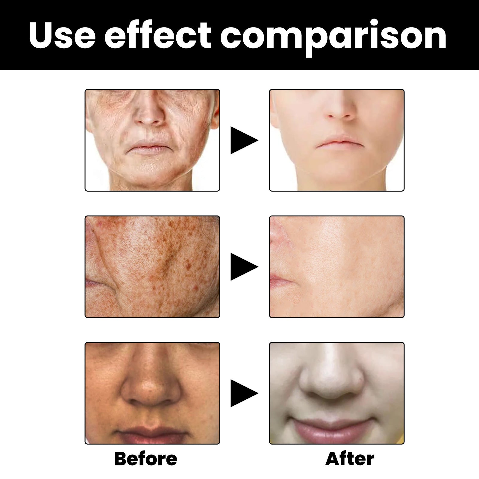 Facial Melanin Repair Essence – Hydrating & Brightening Skincare Dropshipman