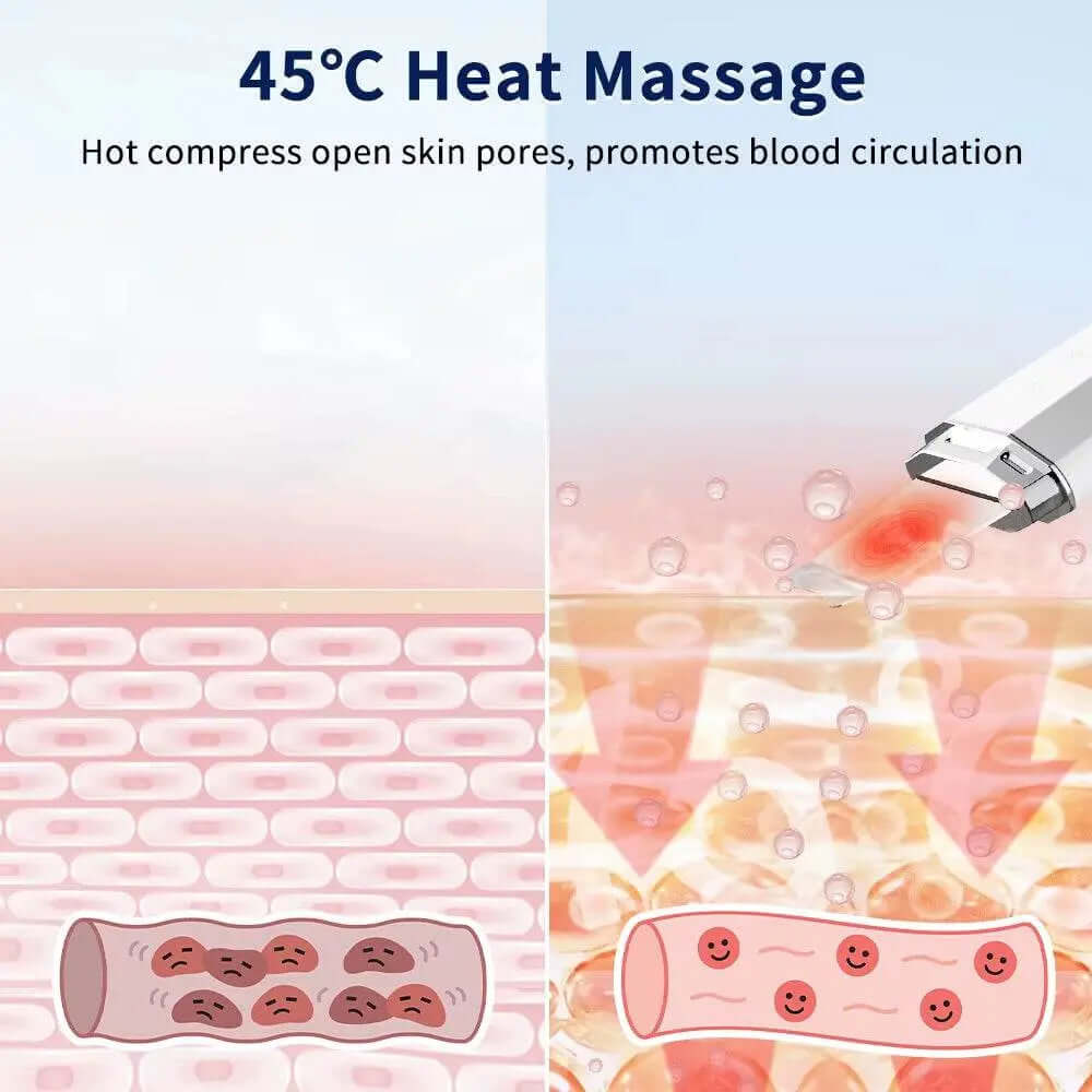 Ultrasonic Skin Scrubber Ion Deep Face Cleaning 45℃ Heat EMS Facial Lifting Ultrasonic Cleaner Peeling Skin Care Device