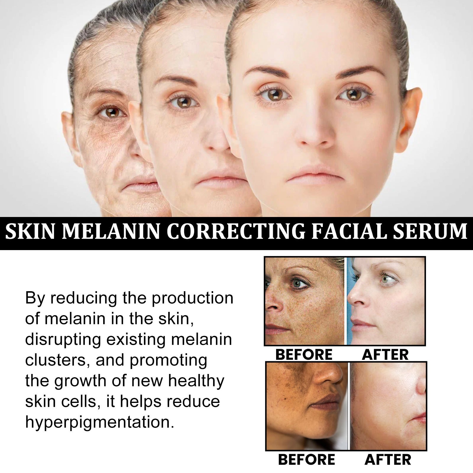 Facial Melanin Repair Essence – Hydrating & Brightening Skincare Dropshipman