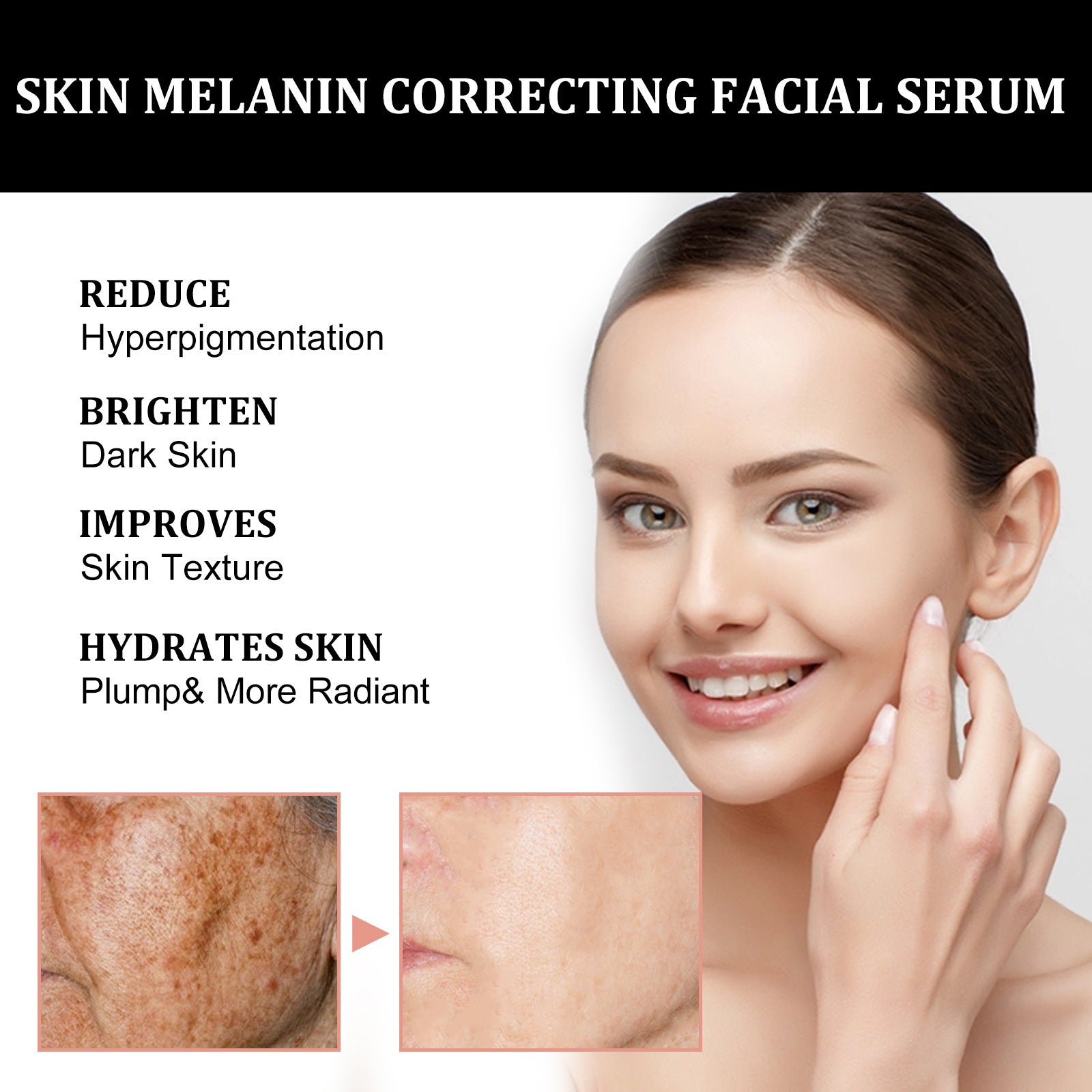Facial Melanin Repair Essence – Hydrating & Brightening Skincare Dropshipman