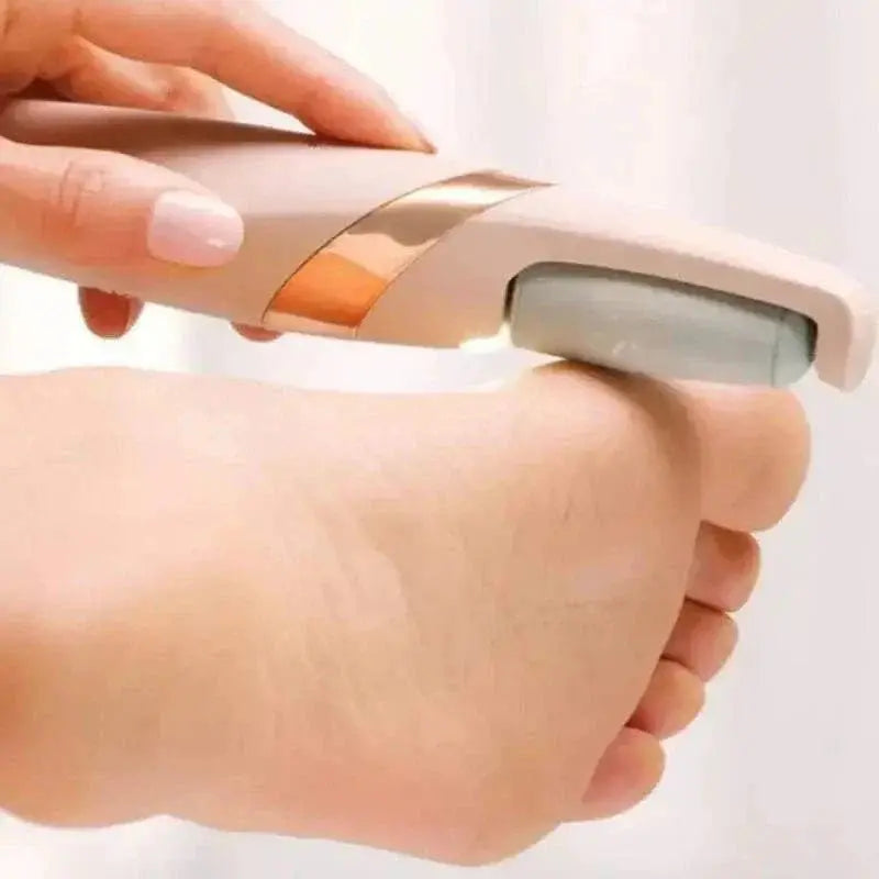 Wireless Electric Foot Grinder gently exfoliating dead skin from heel with ergonomic rechargeable design